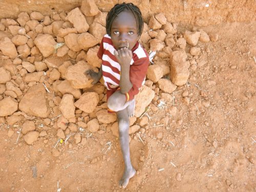 africa starving child